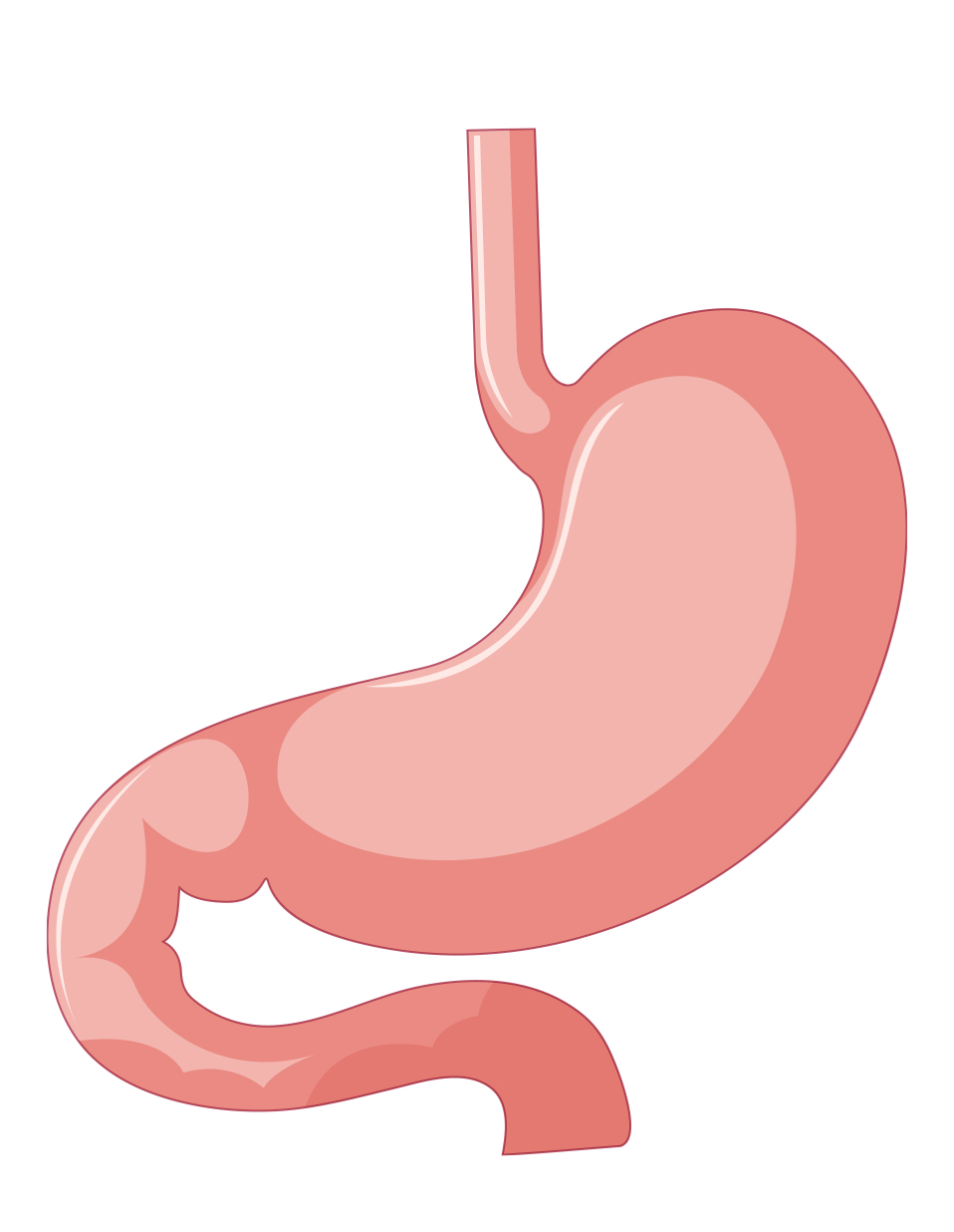 bariatric